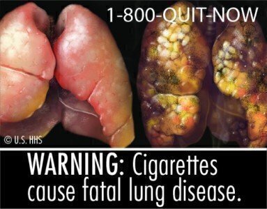 cigarette_health_warning_03-1B_540x422